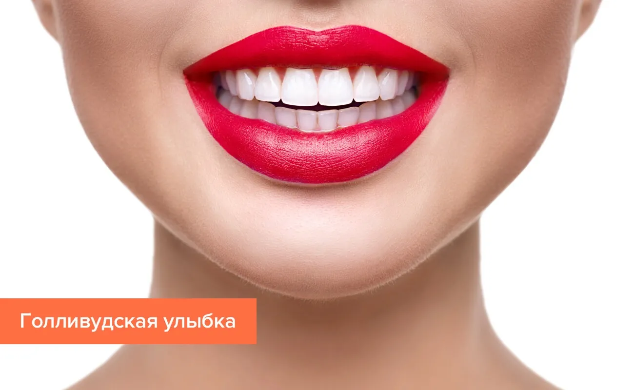 Perfect smile veneers τι είναι - συστατικα - σχολια - φορουμ - κριτικέσ - τιμη - φαρμακειο - αγορα - Ελλάδα.